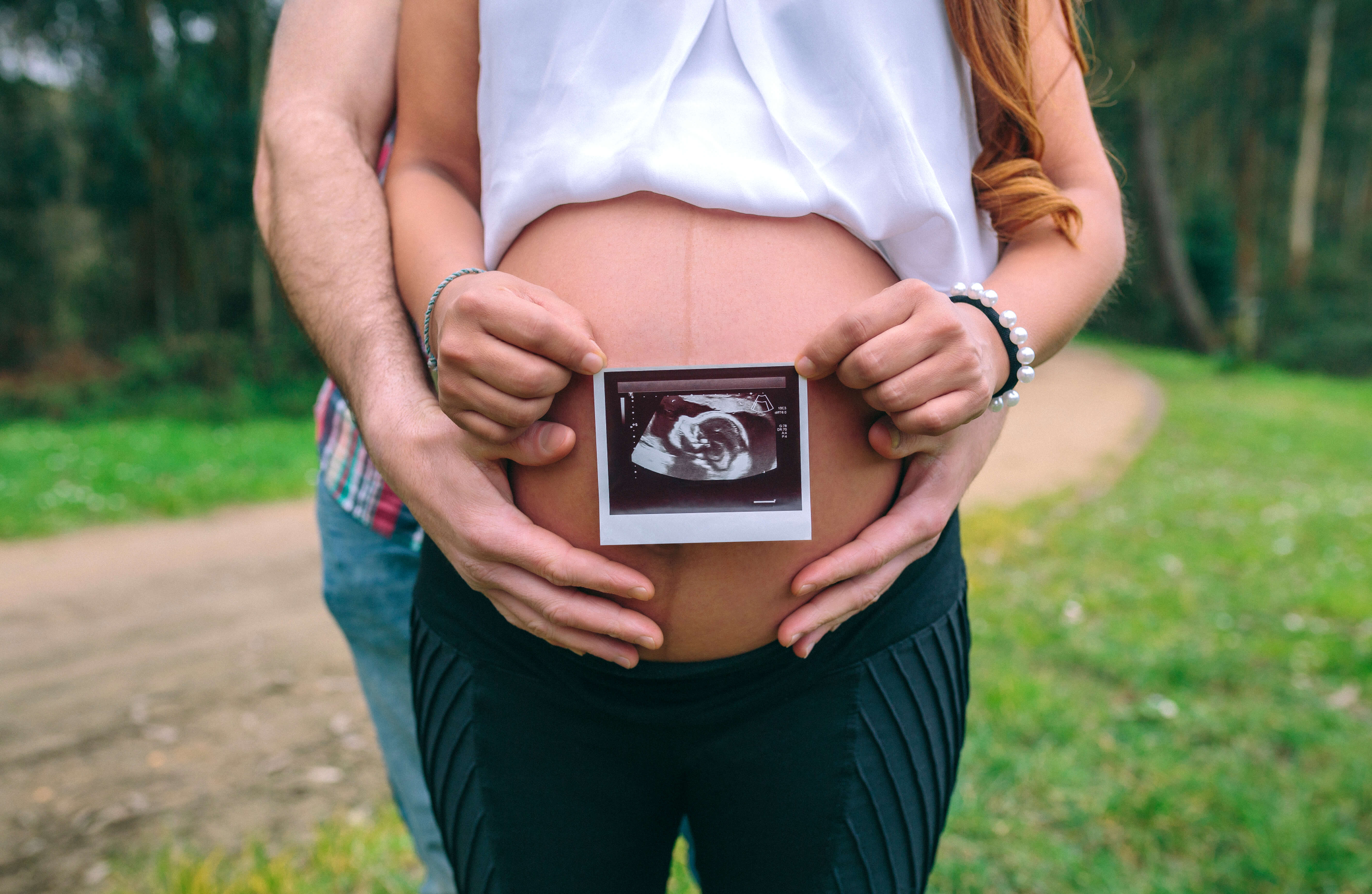 linea nigra olan hamile kadın ultrasonunu gösteriyor